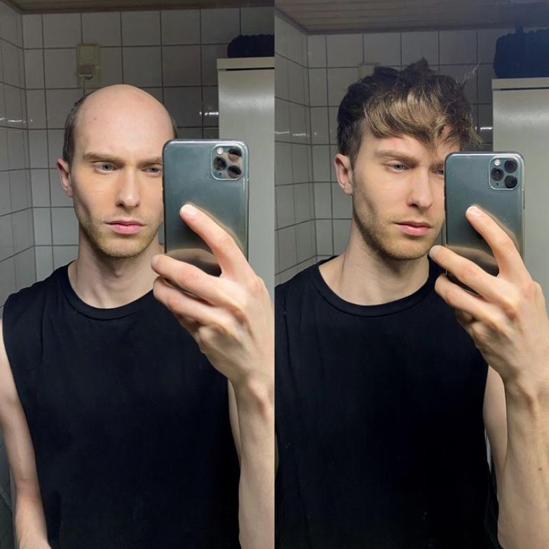 Hair Systems